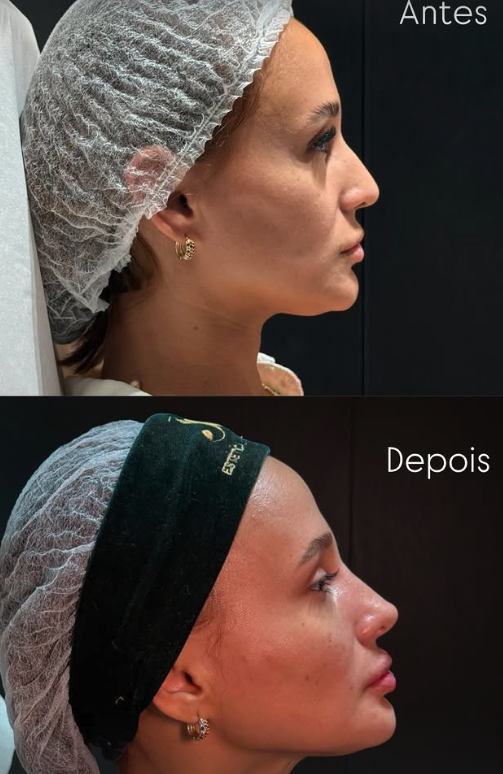 Perfil feminino · harmonização completa